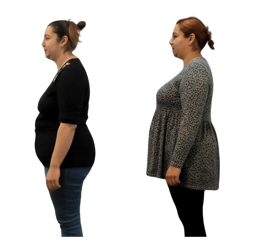 Two full body, side view pictures of a woman, showing her shoulders and posture straightening after Advanced BioStructural Correction™ treatments.