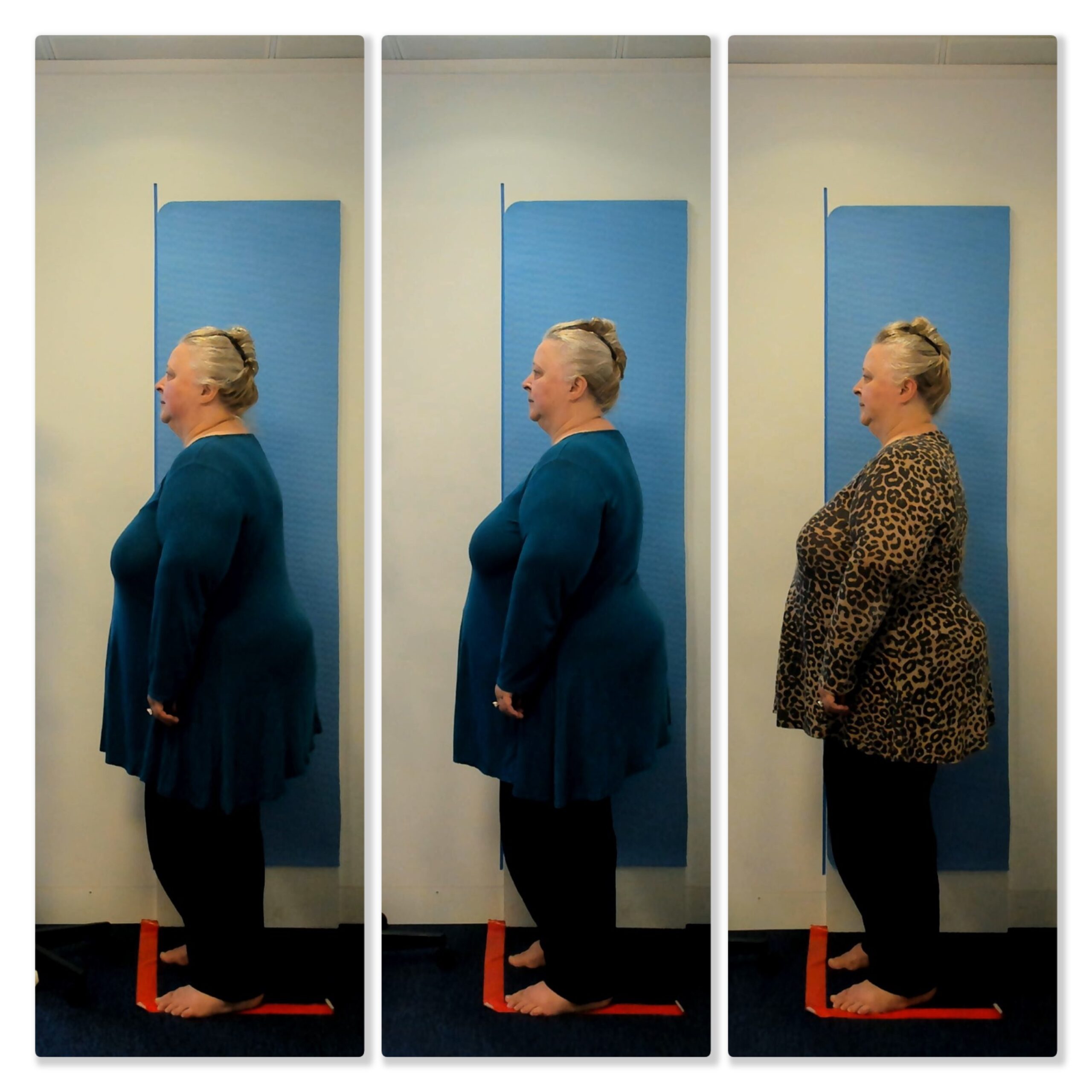 Three full body, side view pictures of a woman, showing her shoulders and posture straightening after Advanced BioStructural Correction™ treatments.