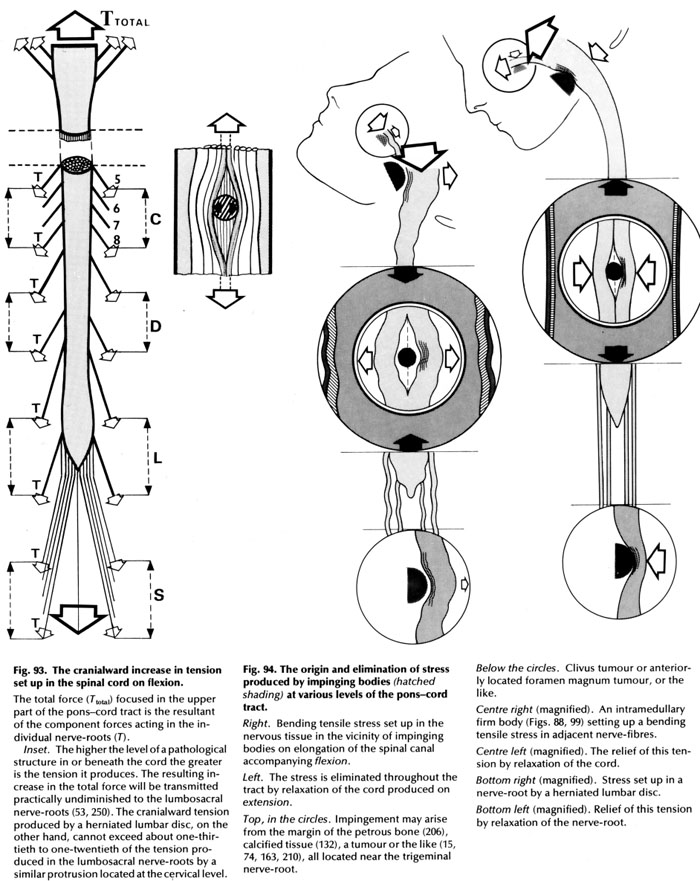 graphic_large_of_tensionSmaller